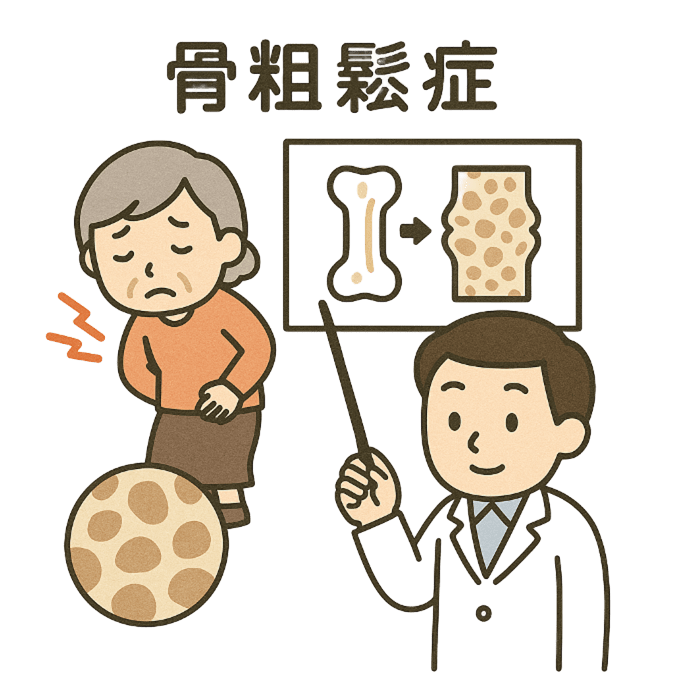 骨粗鬆症関連
