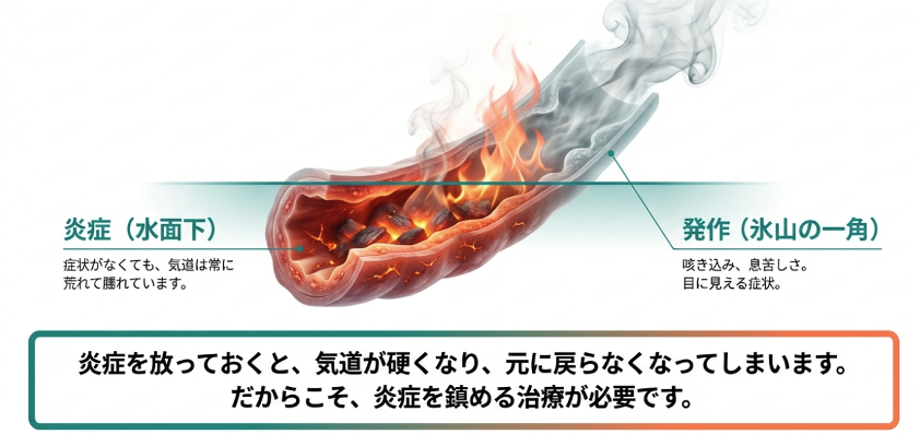 気管支喘息の吸入治療では、見える発作症状の背後にある気道の炎症を抑えることが重要であることを示す図