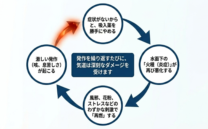 気管支喘息で吸入治療を自己中断すると、炎症が再燃して発作を繰り返す悪循環を示す図。
